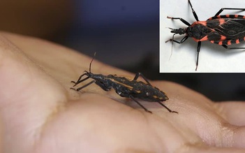 300.000 người Mỹ mắc căn bệnh nguy hiểm mang tên 'Chagas'