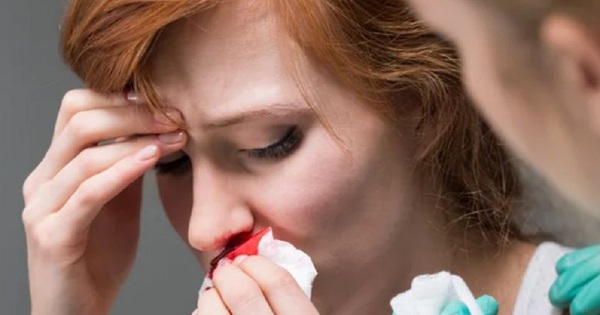 Are Frequent Nosebleeds A Sign Of Cancer