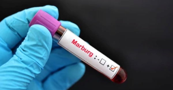 Hiện tại, virus Marburg đã lây lan đến những nước nào? 
