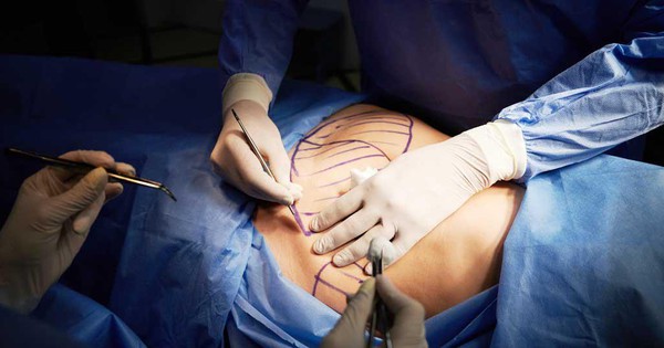 Bệnh nhân tử vong nghi do hút mỡ ở Bệnh viện thẩm mỹ Sao Hàn TP.HCM