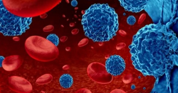 Các yếu tố nguy cơ gây ra ung thư máu di căn?
