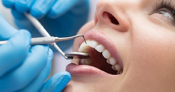 Tại sao răng trám có thể bị sâu lại?