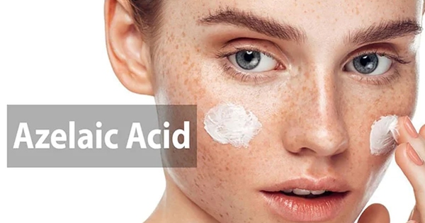 Thành phần và hiệu quả của kem trị mụn azelaic acid mà bạn không thể bỏ qua