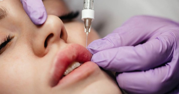 Resolving doubts about ‘lip filler injections’, are they dangerous?