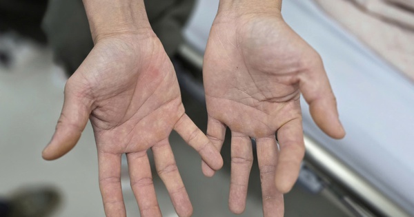 Đứng dậy là ngã, sau thời gian dài hít bóng cười