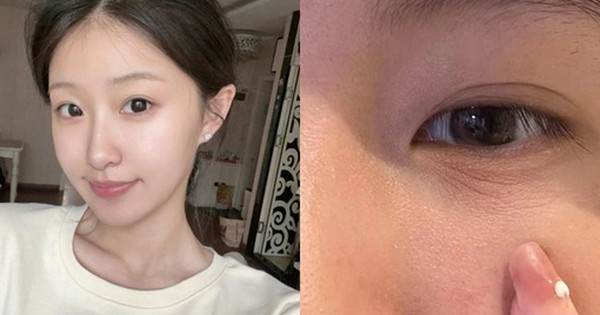 Top 3 kem retinol khiến chị em ‘giật mình’: Da mịn, căng trẻ như mới spa về!