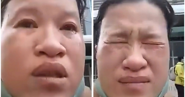 Sự thật clip người phụ nữ kh&oacute;c, n&oacute;i bị m&oacute;c t&uacute;i ở Bệnh viện Nhi Đồng 2