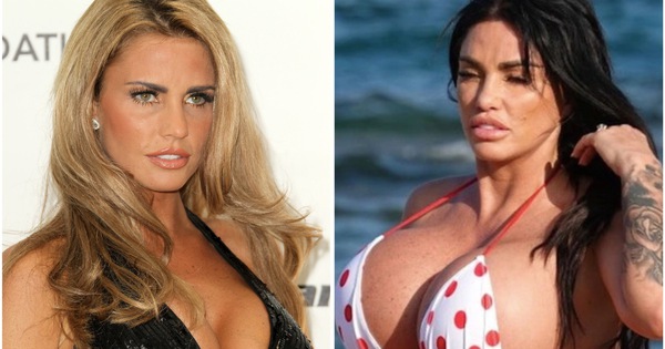 Cựu 'bom sex' bỏ soi gương sau khi mặt biến dạng v&igrave; thẩm mỹ qu&aacute; đ&agrave;