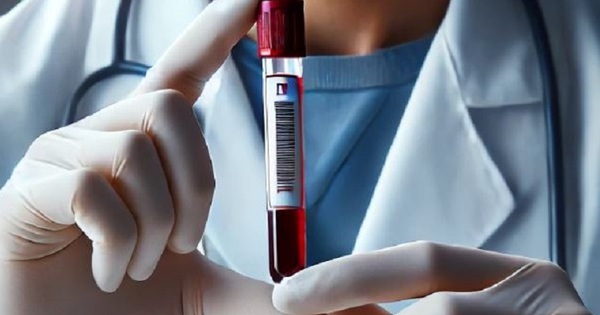 4 x&eacute;t nghiệm m&aacute;u quan trọng n&ecirc;n thực hiện