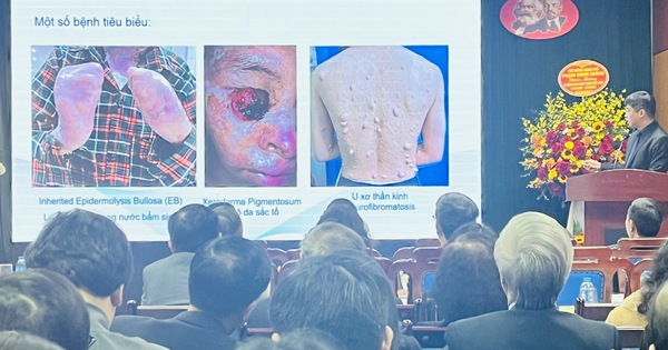 B&aacute;c sĩ Việt Nam đ&oacute;ng g&oacute;p cho quốc tế về điều trị bệnh hiếm
