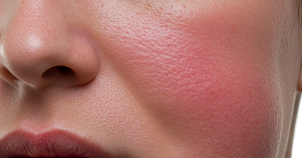 Ng&agrave;y mới với tin tức sức khỏe: Dấu hiệu bệnh thận thường xuất hiện buổi s&aacute;ng