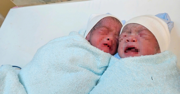 Cứu sống sản phụ v&agrave; cặp song sinh mắc hội chứng truyền m&aacute;u hiếm gặp