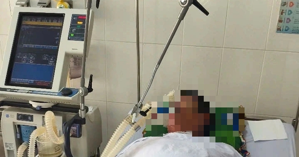 C&agrave; Mau: Ăn c&aacute; n&oacute;c, 4 người nhập viện, trong đ&oacute; 2 người nguy kịch