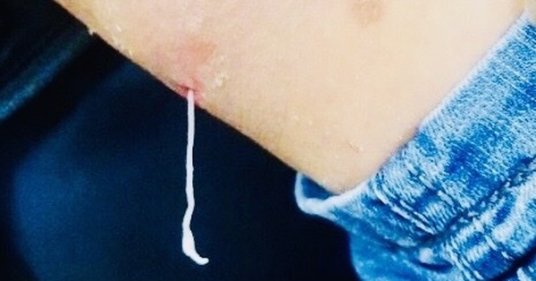 Việt Nam nghi&ecirc;n cứu về lo&agrave;i giun rồng mới ghi nhận