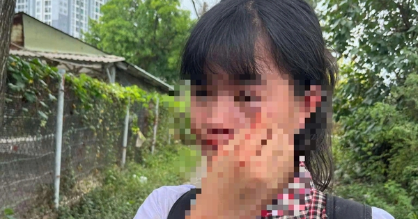 UBND TP.Thủ Đức b&aacute;o c&aacute;o vụ nữ sinh bị h&agrave;nh hung d&atilde; man