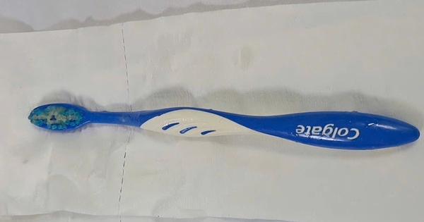 Cứu c&ocirc; g&aacute;i nuốt b&agrave;n chải d&agrave;i 17 cm v&agrave;o thực quản