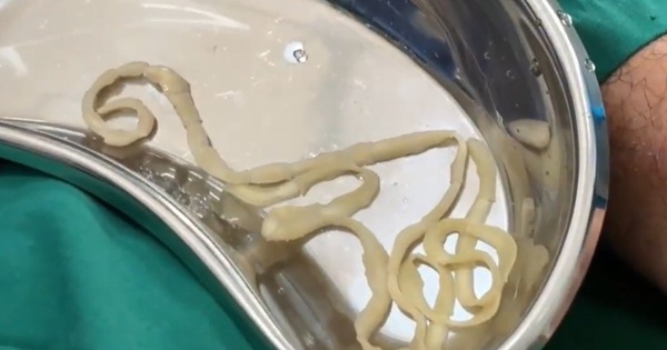 Thường xuy&ecirc;n ăn m&oacute;n t&aacute;i, nam thanh ni&ecirc;n bị s&aacute;n chui qua hậu m&ocirc;n trong l&uacute;c ngủ