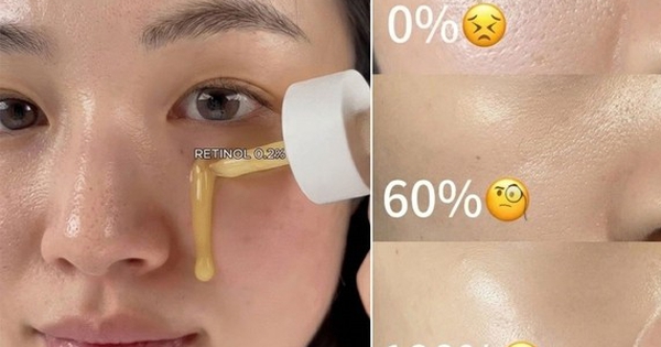 Retinol cho người mới bắt đầu: Đừng để nỗi sợ kích ứng mà quên ‘hoạt chất vàng’