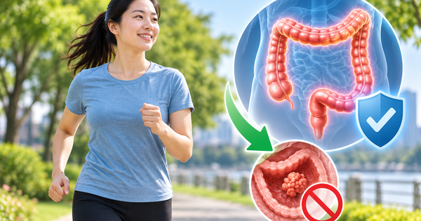 Ung thư đại trực tràng trẻ hóa: 5 cách giúp giảm nguy cơ