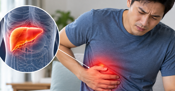 3 dấu hiệu cảnh báo gan nhiễm mỡ đang tiến triển