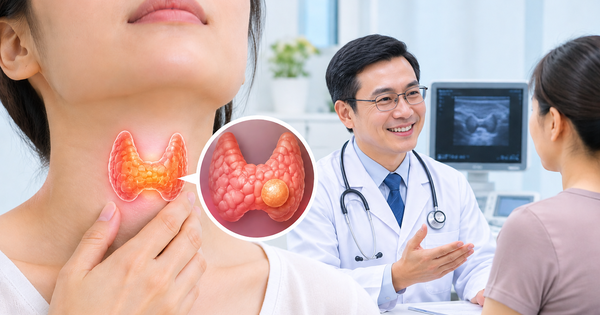 Bác sĩ 24/7: Nhân giáp lành tính có cần phẫu thuật không?