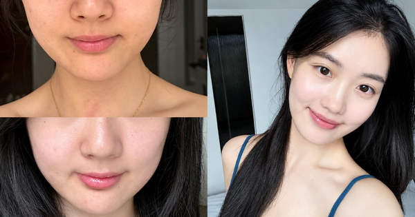 +7 kem dưỡng da mặt tốt nàng nào cũng muốn mua mà ‘cháy hàng liên tục’