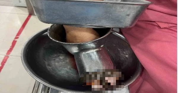 Bị máy xay thịt 'nuốt' bàn tay, người phụ nữ ở TP.HCM phải cắt cụt 3 ngón