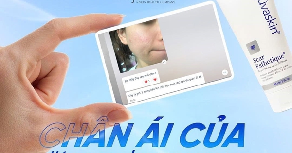 Thâm mụn dùng gì để sau khoảng 4 tuần có làn da láng mịn đều màu?