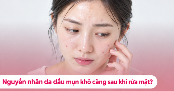 Càng rửa mặt da dầu mụn càng khô căng khó chịu? Hay dùng sai sữa rửa mặt?