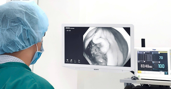 37 tuổi, táo bón xen tiêu lỏng nhiều tháng mới phát hiện ung thư đại trực tràng