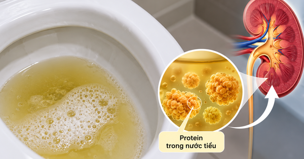 Thận yếu: Bác sĩ dặn đừng bỏ qua dấu hiệu đầu tiên này