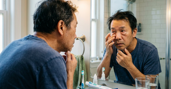 Bệnh thận: Mắt sưng buổi sáng có phải là dấu hiệu sớm?