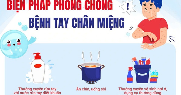 Virus EV71 gây bệnh tay chân miệng có độc lực cao