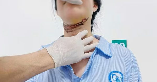 Nữ sinh ở Quảng Trị bị dây giăng ngang đường cứa vào cổ khi đi học về