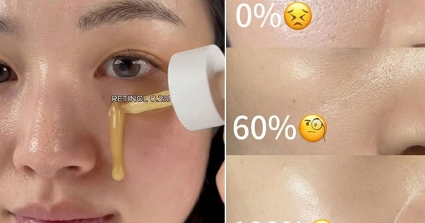 Top 5 retinol đa nhiệm từ mờ nám sạm tới chống lão hóa giúp da căng bóng