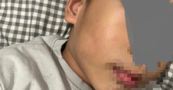 TP.HCM: Trường mầm non Hoa Lư đình chỉ 2 cô có hành vi không chuẩn mực với trẻ