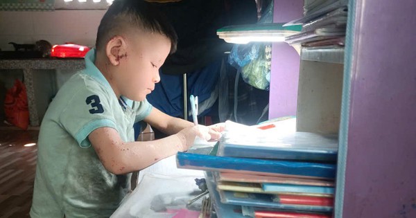 Xin giúp cháu bé mắc bệnh hiếm đang giành giật sự sống