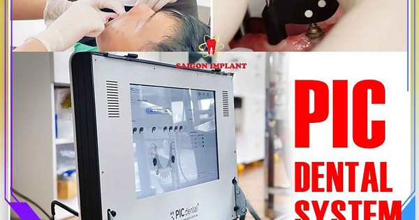 PIC Dental và Face Scan 3D - Tiêu chuẩn vàng cho phục hình Implant toàn hàm