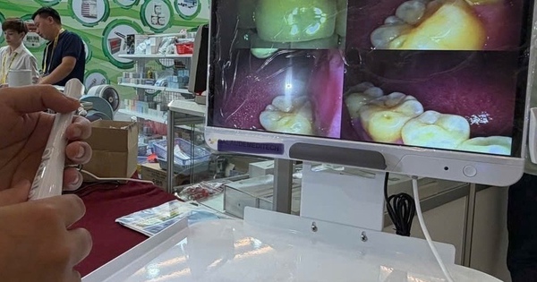 Mỗi người dân sẽ được khám bệnh răng miệng ít nhất 1 lần/năm