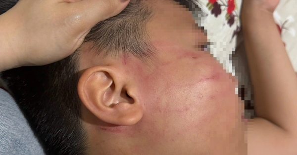 Thầy giáo người Ấn Độ bị tố tát học sinh lớp 4