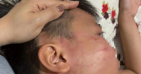 'Cát tát' của giáo viên nước ngoài