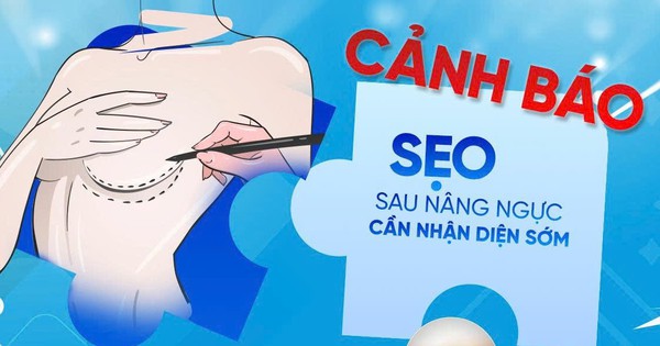 Phẫu thuật thẩm mỹ ngực: Đừng để hành trình tìm lại tự tin ‘đứt gánh’ vì sẹo