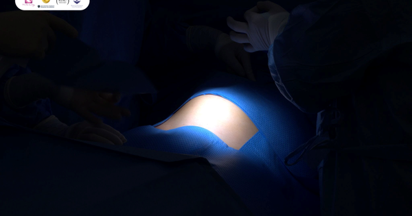Khách hàng quốc tế an tâm điều trị khối đa nhân xơ lớn tại BV Phương Nam