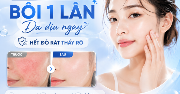Lotion cho da nhạy cảm: Bôi 1 lần, giúp làm dịu da, giảm đỏ rát thấy rõ