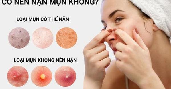 Có nên nặn mụn? Chia sẻ từ chuyên gia khiến nhiều người tiếc vì không biết sớm