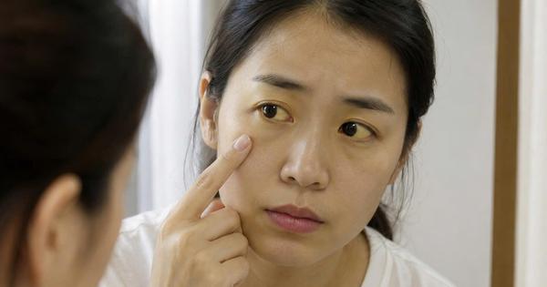 Vàng da, mắt: Khi nào bạn nên đi khám bác sĩ?