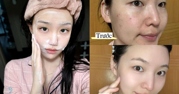 Top 7 sữa rửa mặt cho da hỗn hợp thiên dầu lọt top đầu luôn 'hết hàng'