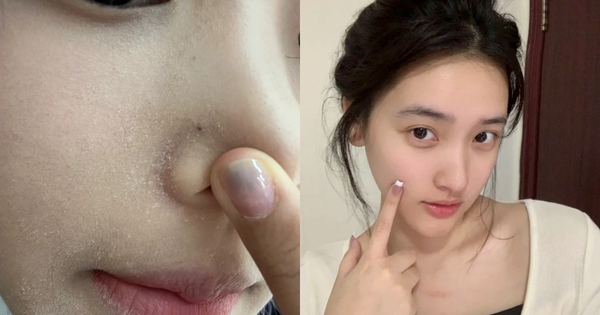 Top 8 sữa rửa mặt cho da khô căng mượt glowy giúp ngăn ngừa lão hóa sớm