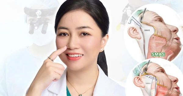 Căng da mặt Deep Plane là gì? Hiểu đúng và áp dụng hiệu quả