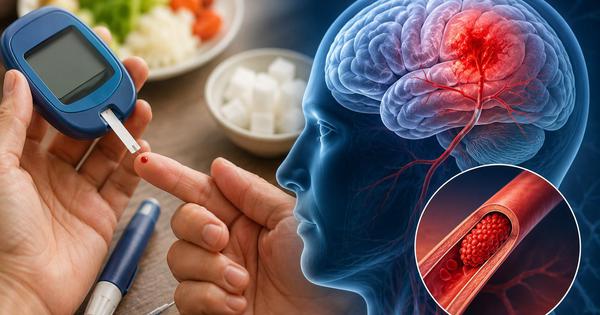 Bác sĩ giải thích vì sao tiểu đường có thể làm tăng nguy cơ đột quỵ